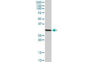 PHOSPHO1 monoclonal antibody (M10A), clone 1A11. (PHOSPHO1 Antikörper  (AA 168-266))