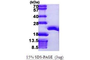 SDS-PAGE (SDS) image for Eukaryotic Translation Elongation Factor 1 epsilon 1 (EEF1E1) (AA 1-174) protein (His tag) (ABIN667425)