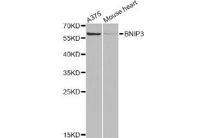 Western blot analysis of extracts of various cell lines, using BNIP3 Antibody. (BNIP3 Antikörper)