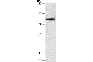 Western blot analysis of Human fetal muscle tissue, using AMPD1 Polyclonal Antibody at dilution of 1:1600 (AMPD1 Antikörper)