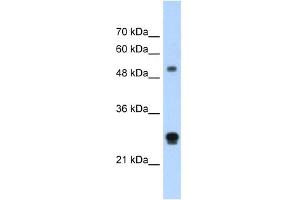 WB Suggested Anti-IGSF1 Antibody Titration:  1. (IGSF1 Antikörper  (N-Term))