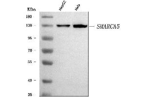 Western blot analysis of SNF2H/SMARCA5 using anti-SNF2H/SMARCA5 antibody (ABIN7602001).