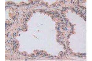 Figure. (LOXL2 Antikörper  (AA 544-751))