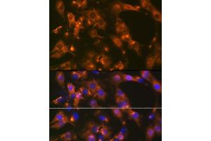 Immunofluorescence analysis of C6 cells using  Rabbit mAb (ABIN1681069, ABIN3018897, ABIN3018898 and ABIN7101684) at dilution of 1:100 (40x lens). (alpha Adaptin Antikörper)