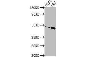 Western Blot Positive WB detected in: U251 whole cell lysate, U87 whole cell lysate All lanes: OTUD3 antibody at 1:1000 Secondary Goat polyclonal to rabbit IgG at 1/50000 dilution Predicted band size: 46 kDa Observed band size: 46 kDa (OTUD3 Antikörper  (AA 108-398))