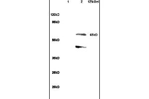 Lane 1: rat heart lysates Lane 2: rat brain lysates probed with Anti SHC3 Polyclonal Antibody, Unconjugated (ABIN715661) at 1:200 in 4 °C.