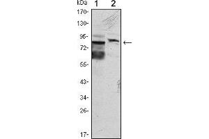 Western blot analysis using KLHL11 mouse mAb against Hela (1) and MCF-7 (2) cell lysate. (KLHL11 Antikörper)