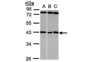 WB Image Sample(30 ug whole cell lysate) A:A431, B:HeLa S3, C:Hep G2 , 10% SDS PAGE antibody diluted at 1:1000 (ASB5 Antikörper)