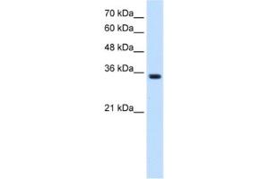 Western Blotting (WB) image for anti-Transient Receptor Potential Cation Channel, Subfamily M, Member 5 (TRPM5) antibody (ABIN2461116)