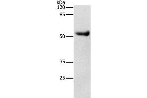 Western Blot analysis of Human liver cancer tissue using DRD4 Polyclonal Antibody at dilution of 1:600 (DRD4 Antikörper)