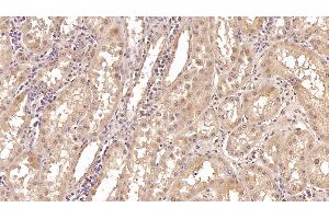 Detection of CRYl1 in Human Kidney Tissue using Monoclonal Antibody to Crystallin Lambda 1 (CRYl1) (CRYL1 Antikörper  (AA 1-319))
