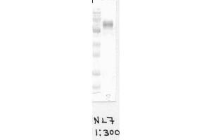 Image no. 1 for anti-Cytochrome B-245, beta Polypeptide (CYBB) antibody (ABIN1042598)