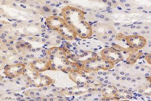 Immunohistochemistry analysis of paraffin-embedded mouse kidney using,CMTM3 (ABIN7073510) at dilution of 1: 4000