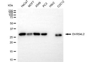 anti-Dehydrogenase/reductase (SDR Family) Member 4 Like 2 (DHRS4L2) antibody