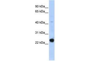 Image no. 1 for anti-Chromosome 16 Open Reading Frame 80 (C16orf80) (AA 71-120) antibody (ABIN6740375) (C16orf80 Antikörper  (AA 71-120))
