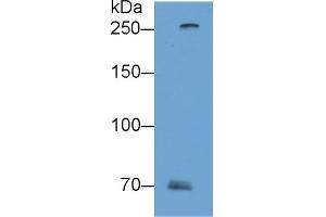Detection of FLG2 in A431 cell lysate using Polyclonal Antibody to Filaggrin 2 (FLG2) (FLG2 Antikörper  (AA 1222-1368))