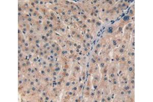 IHC-P analysis of Human Liver Tissue, with DAB staining. (CHI3L1 Antikörper  (AA 112-377))