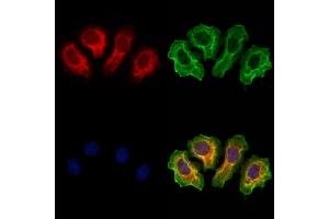 ABIN6264770 and ABIN6273310 staining Hela cells by IF/ICC. (RLBP1 Antikörper  (Internal Region))