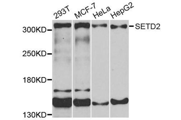 SETD2 Antikörper  (AA 803-1103)