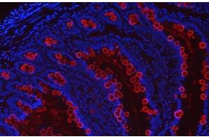 anti-Trefoil Factor 3 (Intestinal) (TFF3) (AA 23-81) antibody