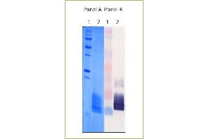 Panel A show SDS-PAGE 15 % Coomassie Blue of AGV 212 trypsin inhibitor purified by Gel filtration.