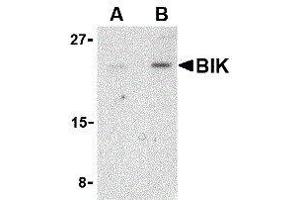 Western Blotting (WB) image for anti-BCL2-Interacting Killer (Apoptosis-Inducing) (BIK) (N-Term) antibody (ABIN2477650)