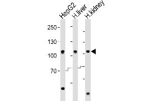 Western blot analysis of lysates from HepG2 cell line, human liver, human kidney tissue (from left to right), using MTTP Antibody (C-term) (ABIN6242904 and ABIN6577849). (MTTP Antikörper  (C-Term))