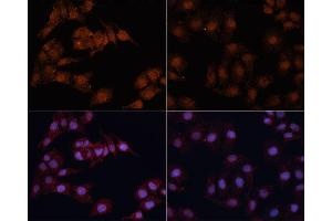 Immunofluorescence analysis of HeLa cells using MAP1LC3B antibody (ABIN6291773) at dilution of 1:100. (LC3B Antikörper)