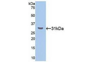 Western blot analysis of recombinant Human RORa. (RORA Antikörper  (AA 164-401))