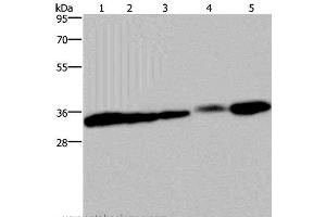Western Blot analysis of HUVEC and 293T cell, Mouse bladder, Human placenta and Mouse kidney tissue using Claudin 23 Polyclonal Antibody at dilution of 1:200 (Claudin 23 Antikörper)