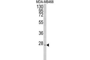 Western Blotting (WB) image for anti-Peroxisomal Biogenesis Factor 11 alpha (PEX11A) antibody (ABIN3004001) (PEX11A Antikörper)