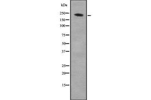 Western blot analysis of ARHGEF17 using K562 whole cell lysates (ARHGEF17 Antikörper  (C-Term))