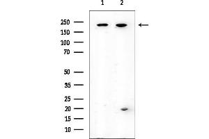 Western blot analysis of lysates from various samples, using eIF4G1 Mouse Monoclonal Antibody at 1/1000 dilution.