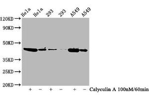 Western Blot Positive WB detected in Hela whole cell lysate,293 whole cell lysate,A549 whole cell lysate(treated with Calyculin A or not) All lanes Phospho-GSK3B antibody at 0.