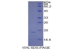 SDS-PAGE analysis of Human Sucrase Isomaltase Protein.