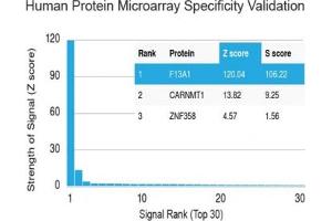 Analysis of HuProt(TM) microarray containing more than 19,000 full-length human proteins using Factor XIIIa antibody (clone F13A1/1448). (F13A1 Antikörper  (AA 46-181))
