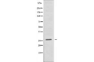 Western blot analysis of extracts from K562 cells, using TNFRSF9 antibody. (CD137 Antikörper  (Internal Region))