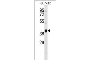 RCH4 Antibody (C-term) (ABIN657255 and ABIN2846352) western blot analysis in Jurkat cell line lysates (35 μg/lane). (MARCH4 Antikörper  (C-Term))