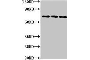 Western Blot Positive WB detected in: 293T whole cell lysate, Hela whole cell lysate, HepG2 whole cell lysate All lanes: NTN1 antibody at 6. (Netrin 1 Antikörper  (AA 186-478))