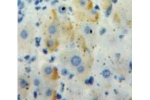 IHC-P analysis of Liver tissue, with DAB staining. (IL18RAP Antikörper  (AA 117-240))