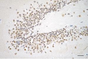 Immunohistochemistry was performed on paraffin-embedded mouse brain using AKAP8 antibody (ABIN7797435), 1:200).