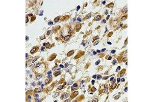 Immunohistochemical analysis of Complement C5 staining in human stomach formalin fixed paraffin embedded tissue section.