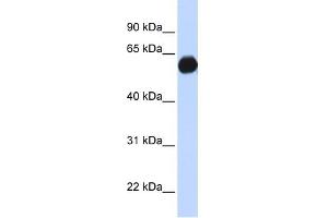 AKAP1 antibody used at 1 ug/ml to detect target protein. (AKAP1 Antikörper)