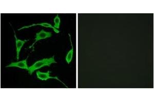 Immunofluorescence analysis of LOVO cells, using GPR85 Antibody. (GPR85 Antikörper  (AA 181-230))