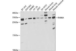 Western blot analysis of extracts of various cell lines, using RA antibody (ABIN6128604, ABIN6146602, ABIN6146604 and ABIN6221246) at 1:1000 dilution. (RAB6A Antikörper  (AA 1-200))