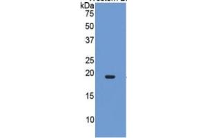 Western Blotting (WB) image for Interleukin 17 (IL17) ELISA Kit (ABIN6730906)