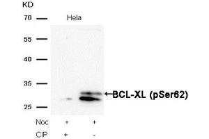 Western Blotting (WB) image for anti-BCL2-Like 1 (BCL2L1) (pSer62) antibody (ABIN7193159)