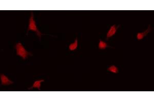ABIN6268978 staining Hela by IF/ICC. (LCK Antikörper  (pSer59))