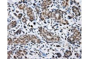 Immunohistochemical staining of paraffin-embedded breast tissue using anti-SHC1 mouse monoclonal antibody. (SHC1 Antikörper)