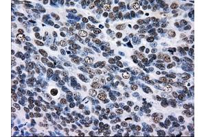 Immunohistochemical staining of paraffin-embedded Kidney tissue using anti-RPA2 mouse monoclonal antibody. (RPA2 Antikörper)